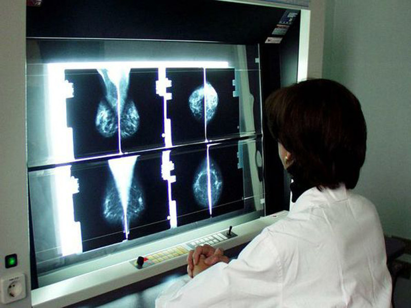Screening oncologici,prevenzione per la lotta ai tumori