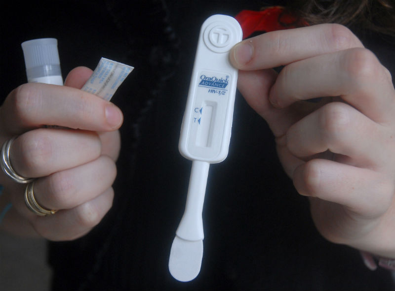 Materiale occorrente per una diagnosi del virus HIV mediante test salivare