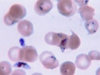 malaria