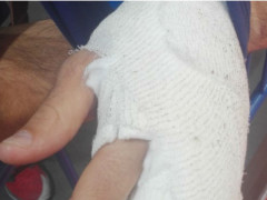 Infortunio alla mano per Pierantoni