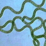 Micro-alga verde-azzurra, Spirulina