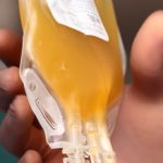 Terapia al plasma iperimmune