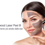 SpaMarine - Carbon Laser Peel
