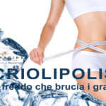 Criolipolisi da Spamarine a Senigallia