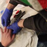 Anelli rimossi a una donna al pronto soccorso di Senigallia