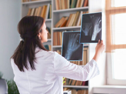 Radiografia a domicilio