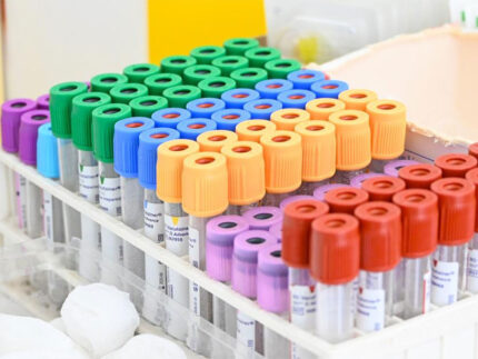 Ricerca scientifica, medicina, provette, laboratorio medico